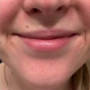 After Image: Lip Flip