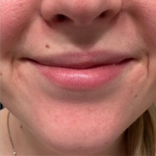 After Image: Lip Flip - front