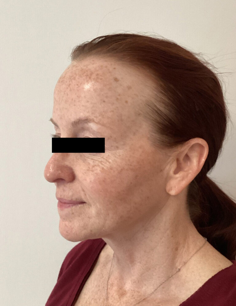 After Image: ADVATx - left-front-oblique